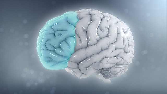 u344-Attention_deficit_hyperactivity_disorder_-_Attention_deficit_hyperactivity_disorder_-_Reduced_brain_volume_on_the_left_side_from_ADHD